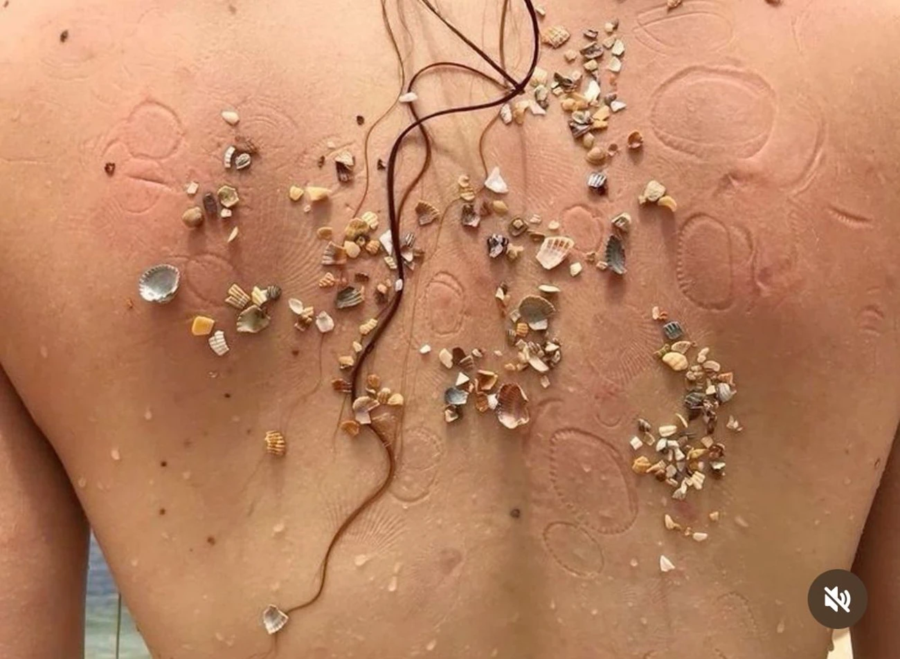 skin