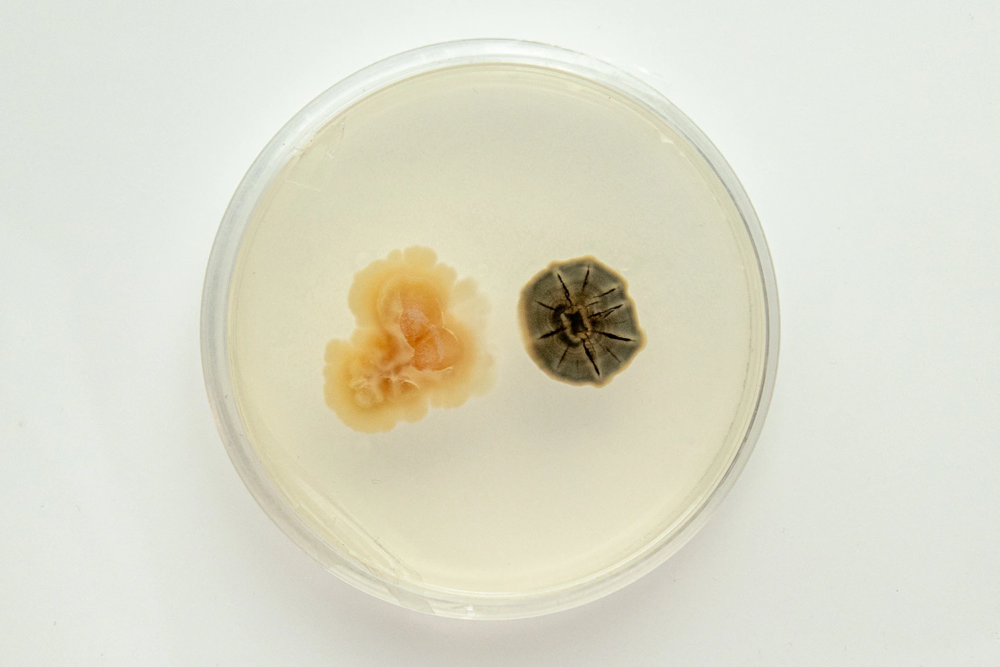 The darker fungus visible on the PDA medium is Ramularia mali, isolated from a Golden apple in South Tyrol. The fungus next to it, like Ramularia mali, also belongs to the Ascomycetes. photo from the phytopathology research group at the Laimburg Research Center, thanks to Vera Christandl and Agnese Martinelli.