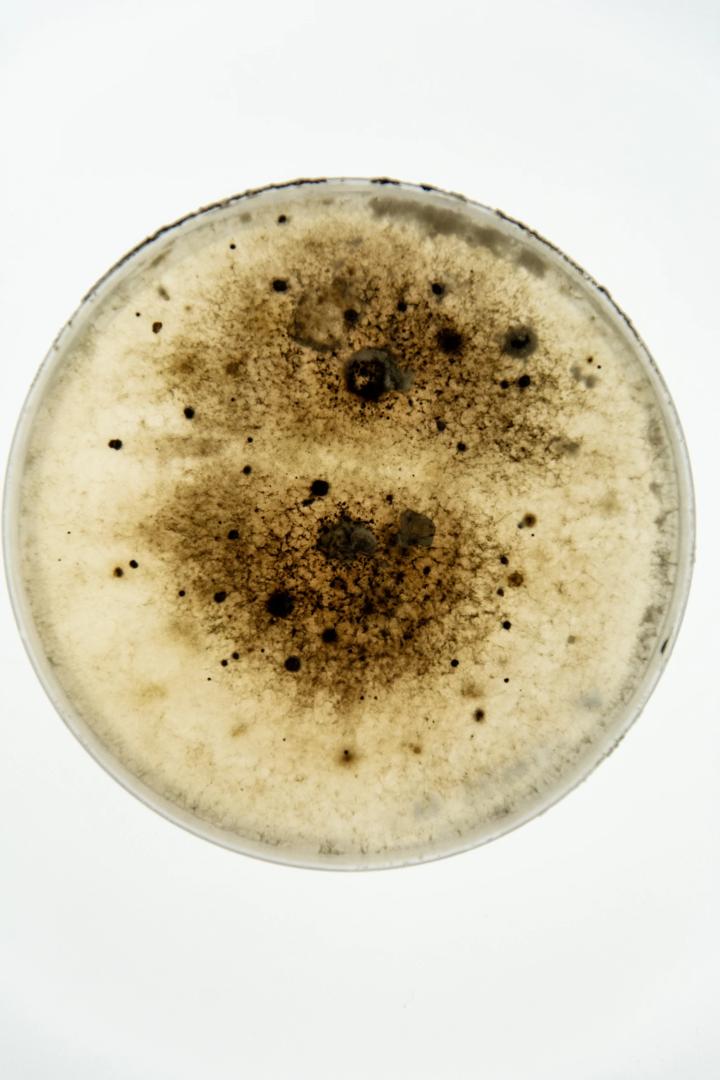 The displayed culture shows a PDA Petri dish with the fungus Colletotrichum chrysophilum. The black structures are the fruiting bodies (perithecia), which contain the sexual spores (ascospores). This fungal isolate originates from the internal database of the Phytopathology Research Group at the Laimburg Research Centre. photo from the phytopathology research group at the Laimburg Research Center, thanks to Vera Christandl and Agnese Martinelli.
