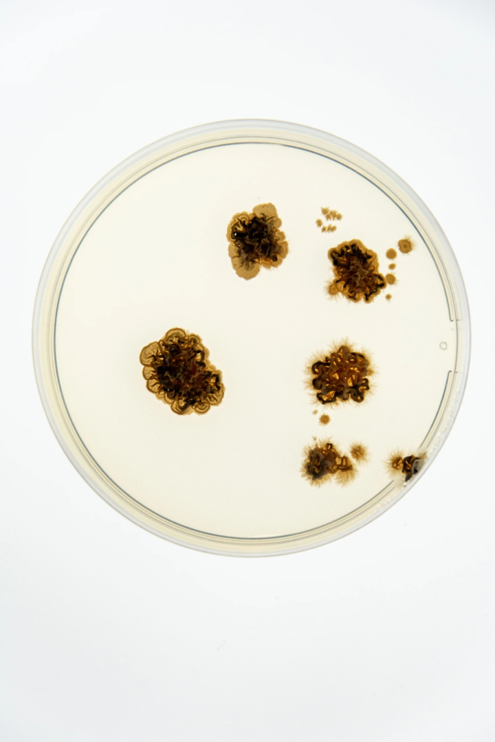 Petri dish with PDA medium containing explants from an apple showing symptomatic Glomerella leaf spot. Visible is the mycelium of the fungus Colletotrichum chrysophilum, the causal agent of Glomerella leaf spot disease. photo from the phytopathology research group at the Laimburg Research Center, thanks to Vera Christandl and Agnese Martinelli.
