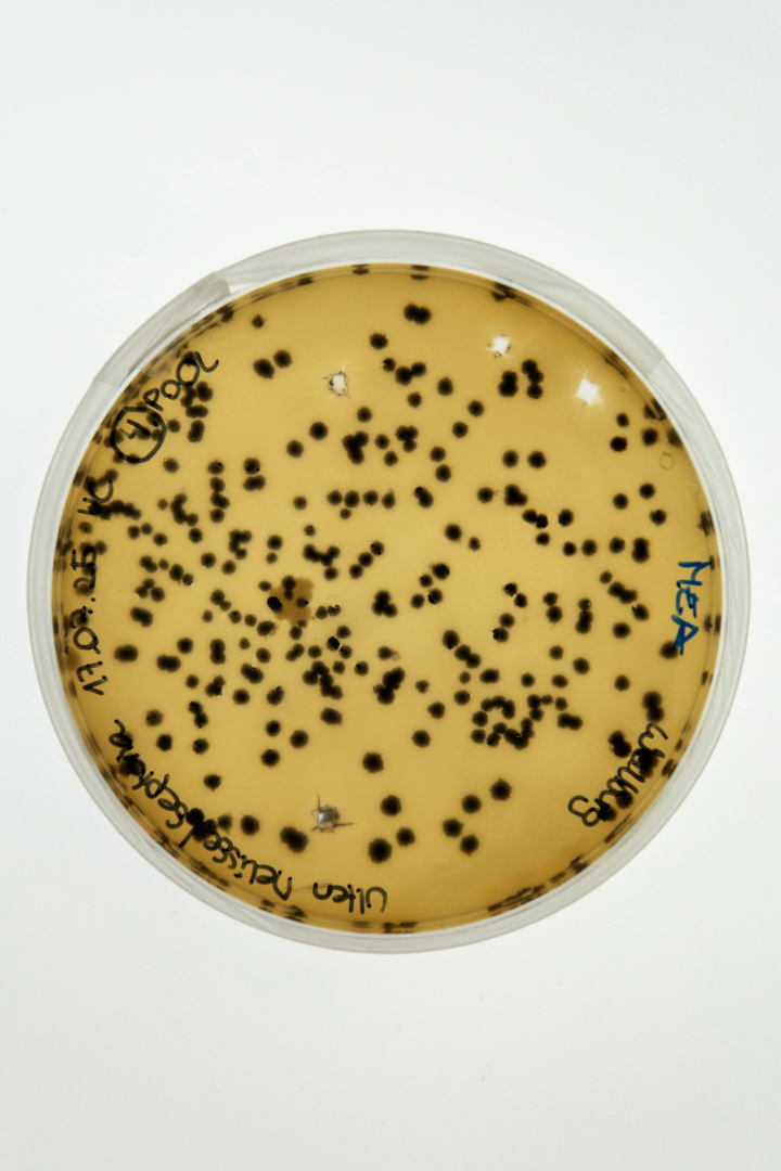 Fungal growth of Septoria melissae cultured on Malt Extract Agar (MEA) medium. The isolate originated from Melissa officinalis leaf samples showing symptoms of Septoria spp. Infection. photo from the phytopathology research group at the Laimburg Research Center, thanks to Vera Christandl and Agnese Martinelli.