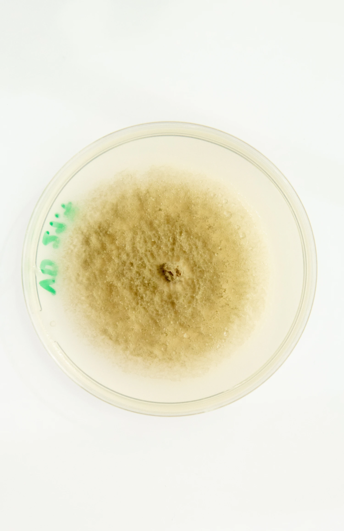 Leaf samples of Melissa officinalis showing symptoms of Septoria spp. The samples were cultured on Melissae-B medium, supporting the growth of Septoria melissae.
photo from the phytopathology research group at the Laimburg Research Center, thanks to Vera Christandl and Agnese Martinelli.