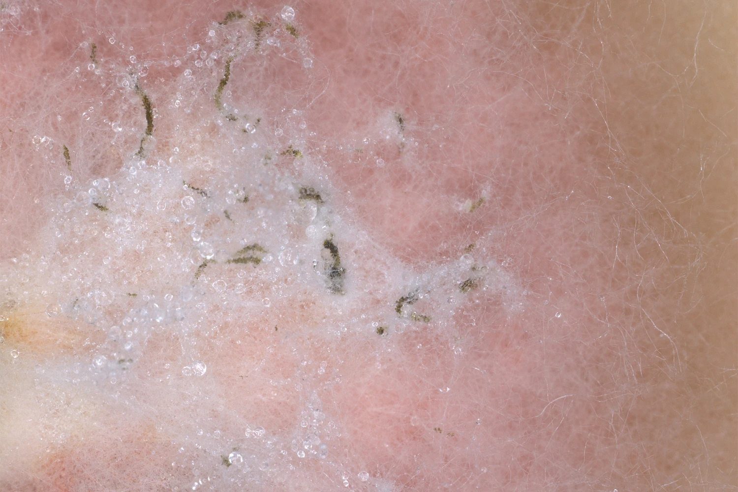 Hyphae of Fusarium spp. observed under the binocular microscope. Photo from the phytopathology research group at the Laimburg Research Center, thanks to Vera Christandl and Agnese Martinelli