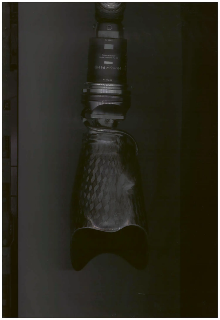 Harmony P4, Ottobock prosthesis